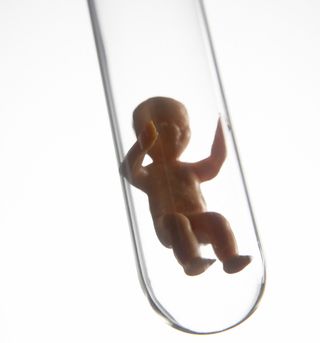IVF vruchtbaardheidsbehandeling