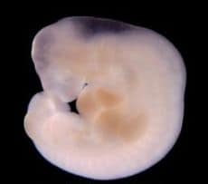 embryo 28 dagen