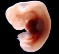 Embryo 41 dagen