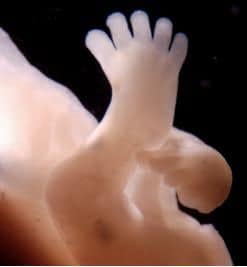 Embryo 54 dagen