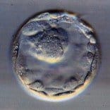 Zygote op dag 6 na de bevruchting