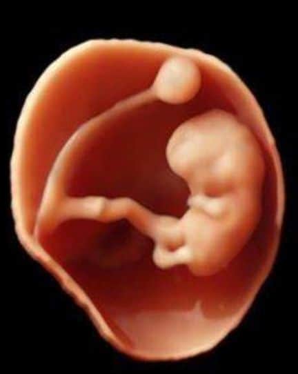 dooierzak bij embryo 9 weken zwangerschap