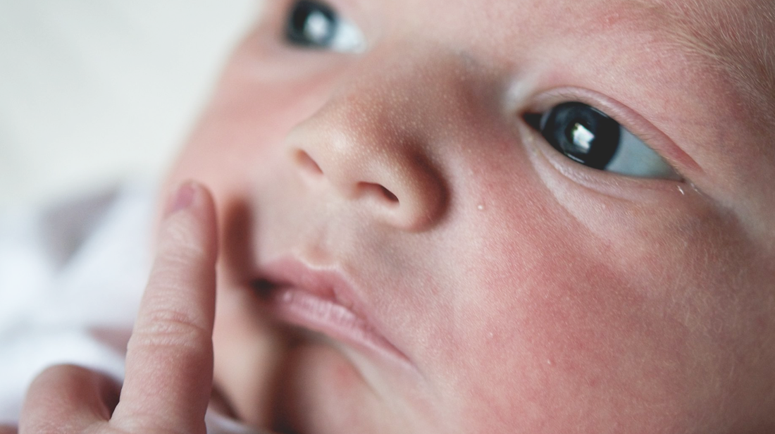 Baby acne: baby heeft oorzaken en oplossingen
