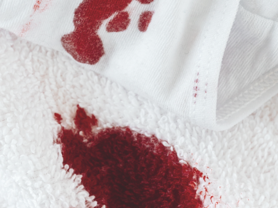 overmatig bloedverlies bevalling