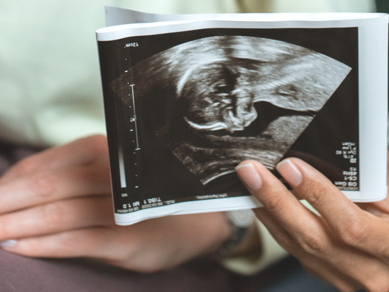 Tweede trimester zwangerschap wat kun je verwachten + tips